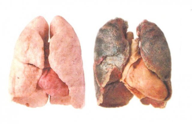 akciğer temizliği nasıl  yapılır